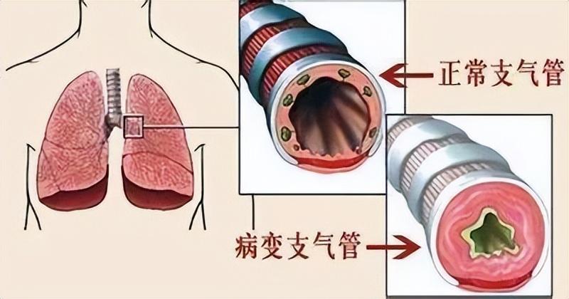 三个月的宝宝有点咳嗽